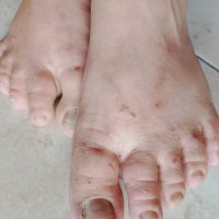 Ugly Feet